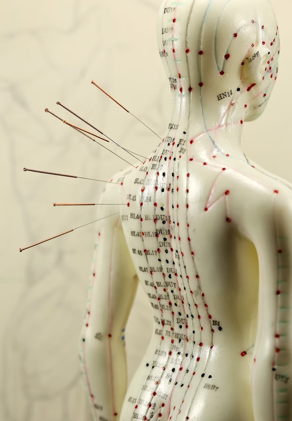 Acupuncture model showing needle points along the back